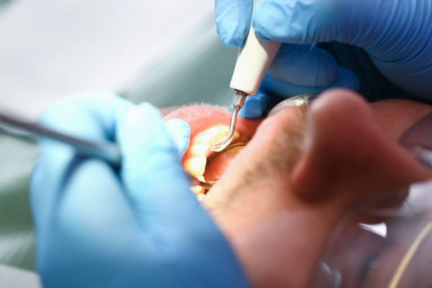 Best Emergency Dentist for Knocked-Out Tooth in Columbus, NC