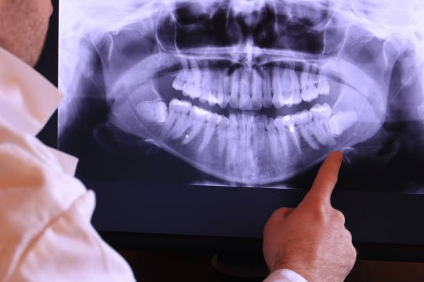 Best Emergency Dental Care for Abscessed Tooth in Columbus, NC